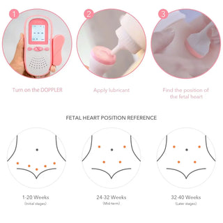 SpringBud Fetal Doppler